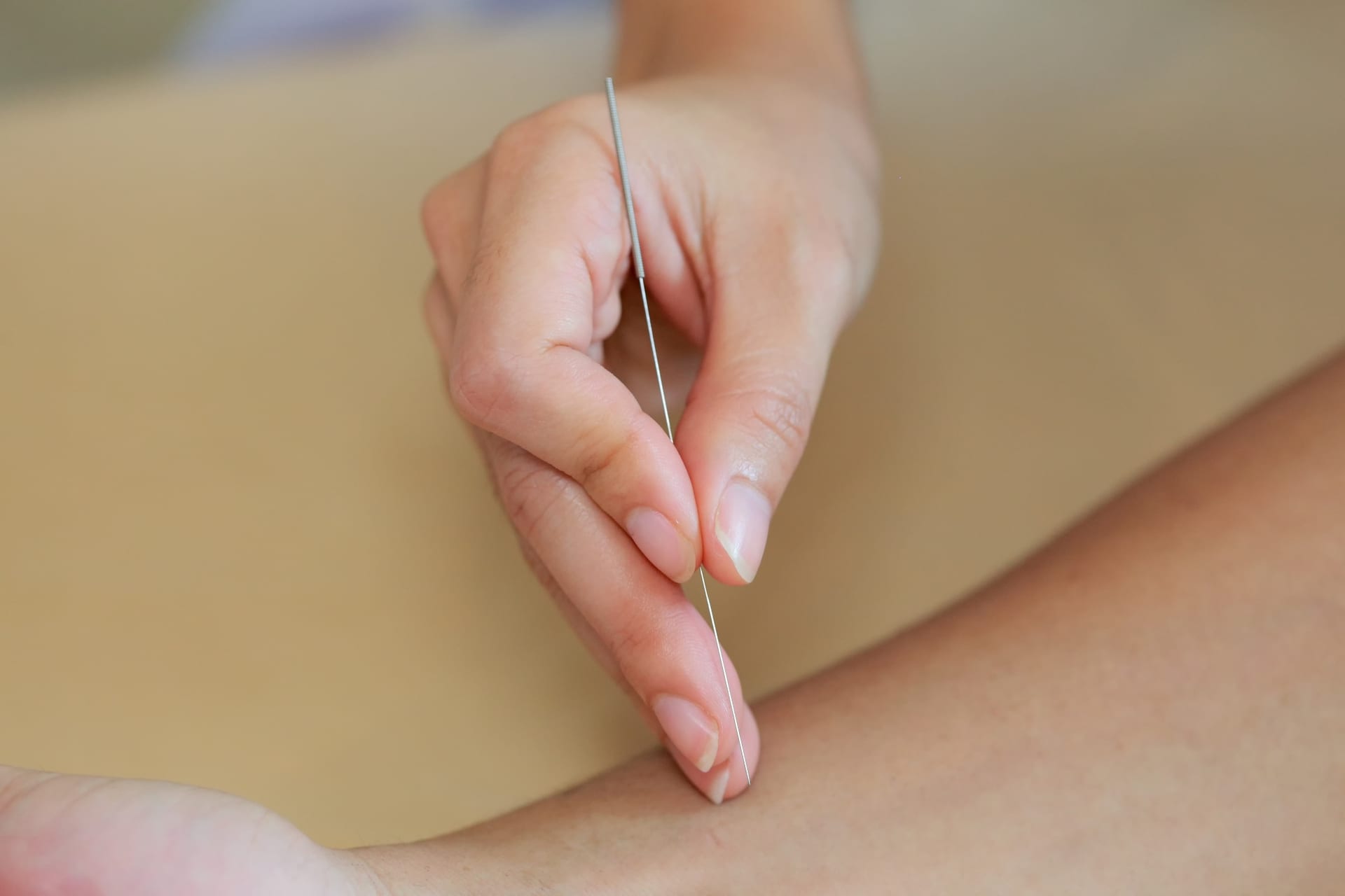 Tempe, AZ – Benefits of Dry Needling Services for Orthopedics & Physical Therapy